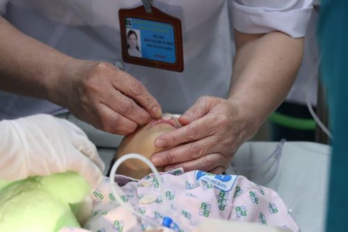 Ca xạ trị đặc biệt cho bé gái mắc ung thư vùng kín