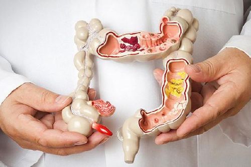 5 loại ung thư đường tiêu hóa thường gặp và cách phòng ngừa