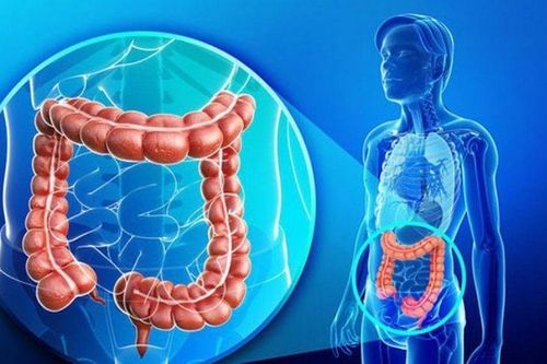 Hội chứng ruột kích thích cần xử trí như thế nào?