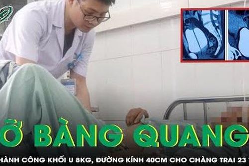 Vỡ bàng quang do uống bia quá mức, phải phẫu thuật gấp