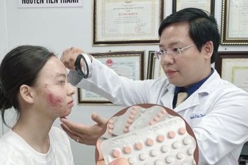 Mặt 'tan nát' sau 3 tuần uống thuốc tránh thai điều trị mụn