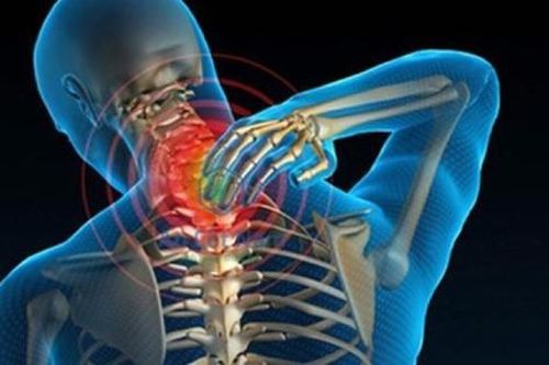 4 nguy cơ gây thoái hóa cột sống cổ
