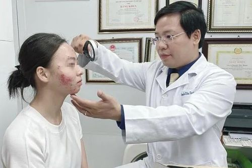 Viêm da do tự ý uống thuốc tránh thai khẩn cấp để... trị mụn