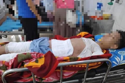 Nam sinh 11 tuổi ở Tuyên Quang phải đi cấp cứu với vết thương vùng kín nặng nề do tai nạn nhiều người không ngờ tới