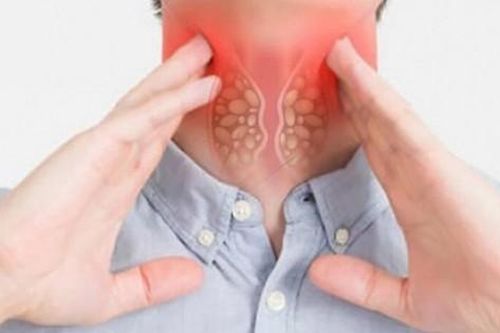 Dấu hiệu của bệnh ung thư tuyến giáp đã di căn xa