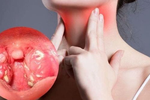 Bảo vệ răng miệng và họng toàn diện với Careox