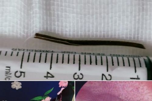 Hóc cành cây khi uống thuốc nam