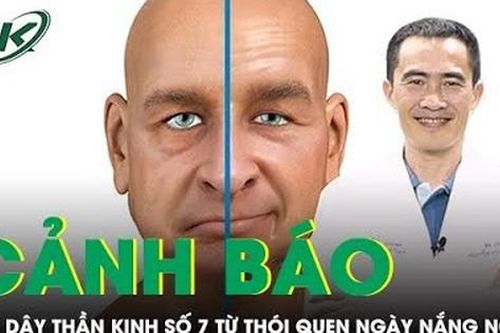 Liệt dây thần kinh số 7 từ thói quen ngày nắng nóng
