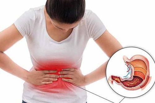 Khi nào cần điều trị vi khuẩn HP?