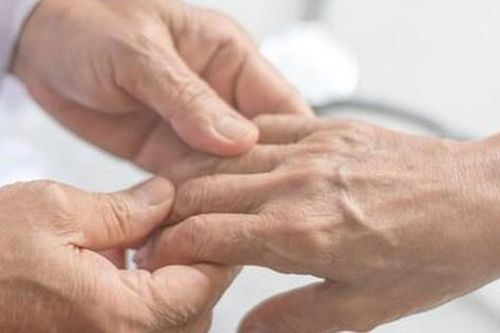 Lựa chọn thuốc kiểm soát cơn đau do viêm khớp