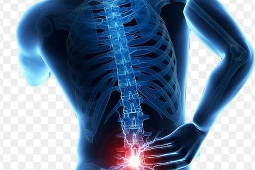 Thoát vị đĩa đệm: Nguyên nhân, biểu hiện, cách điều trị và phòng bệnh