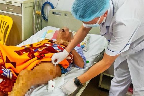 Thay khớp háng thành công cho cụ ông 71 tuổi bị xơ gan nặng