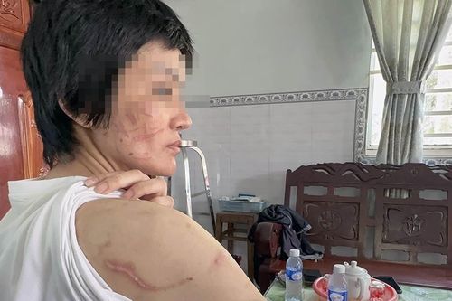 Bạo lực với phụ nữ gây thiệt hại hơn 100.000 tỷ đồng/năm