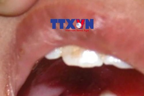 Xử phạt người đăng tải thông tin sai sự thật về bệch bạch hầu