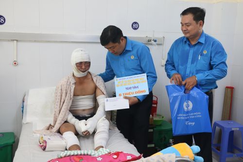 Hai công nhân bị bỏng toàn thân trong vụ cháy ở công ty gỗ