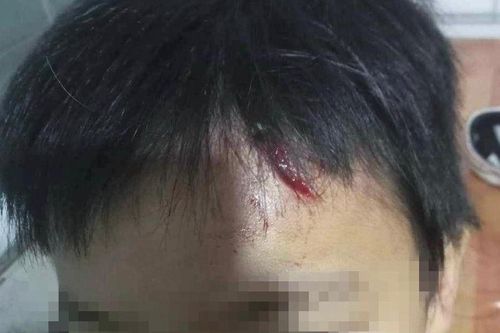 Lời khai của cháu bé ở Cà Mau nghi bị mẹ kế bạo hành