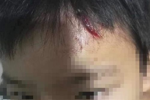 Lời kể của bé trai 10 tuổi nghi bị mẹ kế bạo hành ở Cà Mau