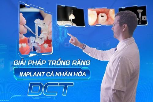 Giải pháp trồng răng implant cá nhân hóa DCT - Xu hướng trồng răng thế kỷ XXI