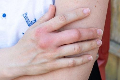 Một dấu hiệu cảnh báo bệnh thận không nên bỏ qua