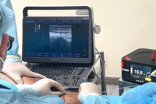 Loét chân vì 38 năm bị suy giãn tĩnh mạch không trị