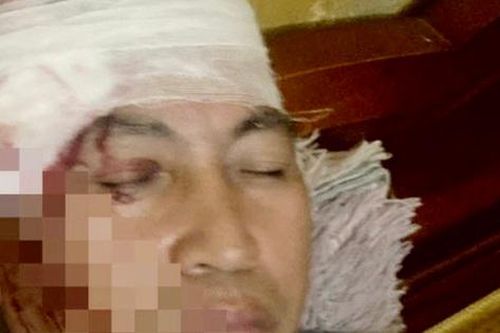 Người dân ném đá khiến lái tàu bị thương nặng khi đang điều khiển đầu máy tuyến đường sắt Hà Nội - Lào Cai
