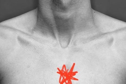 Đau xương ức có thể là dấu hiệu cảnh báo bệnh nghiêm trọng