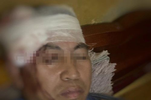 Phụ lái bị ném đá vỡ đầu khi tàu hỏa chạy qua Yên Bái