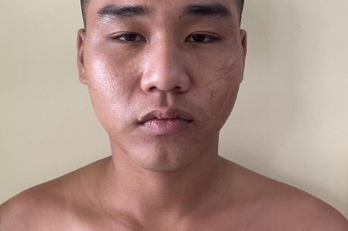 Vụ người phụ nữ thuê giang hồ chém chủ nợ dằn mặt ở Gia Lai: Bắt giữ thêm 1 nghi phạm