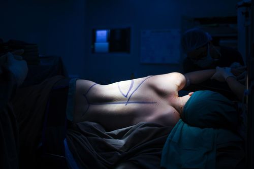 Căn bệnh ung thư đứng đầu tại Việt Nam