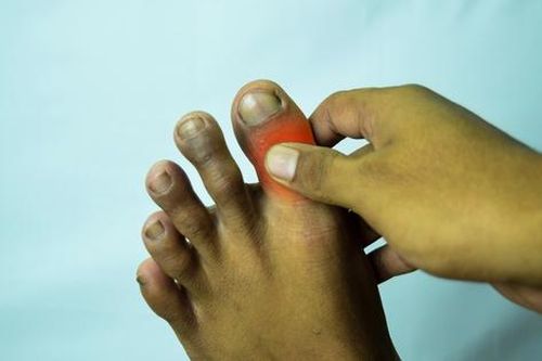 Đau nhói ở ngón chân cái như bị kim châm là bệnh gì?