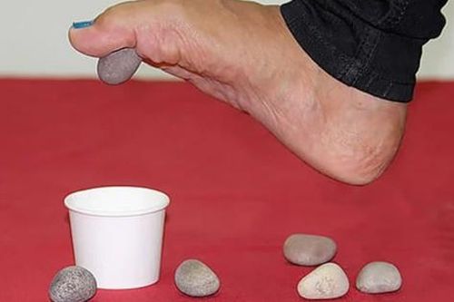 Bài tập phục hồi cho người bệnh bàn chân bẹt