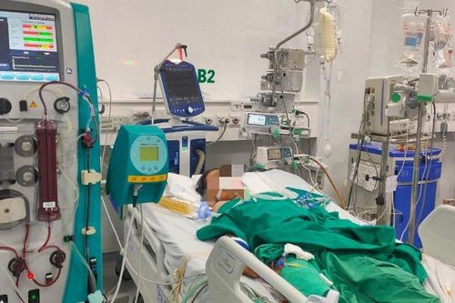Trẻ nguy kịch do bị ong đốt vào mi mắt