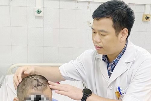 Người đàn ông tự đóng đinh vào đầu