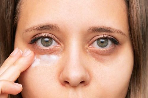 Lưu ý sử dụng kem trị quầng thâm mắt