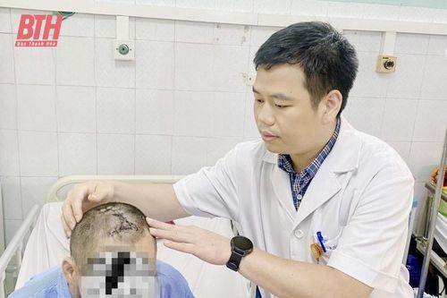 Cứu sống nam bệnh nhân tự đóng đinh sắt vào đầu