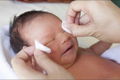 Câu hỏi thường gặp liên quan đến tắc tuyến lệ