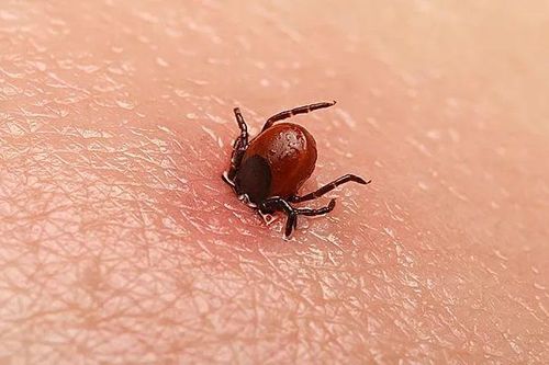 Sốt cao nhiều ngày do ấu trùng mò
