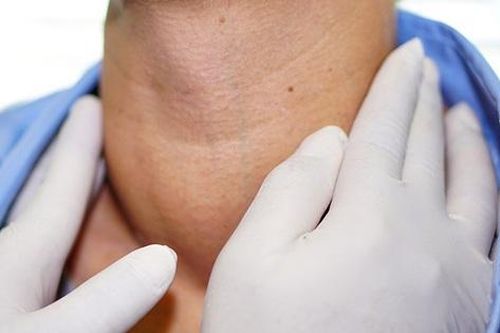Các phương pháp điều trị bướu cổ