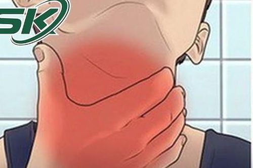 Phòng bệnh bạch hầu nhưng không lạm dụng cách ly rộng rãi