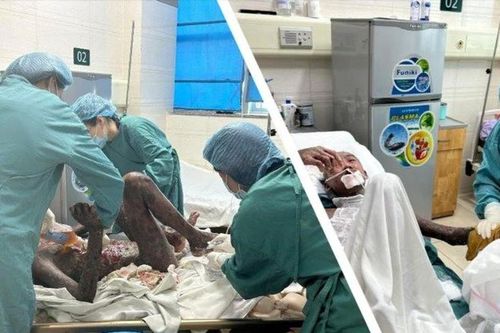Điều trị thành công bệnh lý hiếm gặp trên thế giới