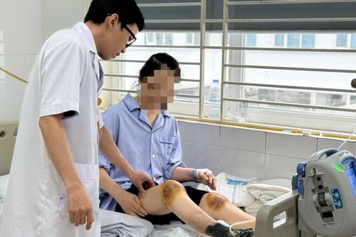 Người phụ nữ bị hoại tử chân vì dùng ong đốt vào đầu gối chữa bệnh