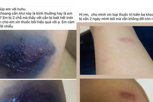 Sinh viên Ký túc xá Khu B, ĐHQG TP. HCM lo lắng vì bị kiến ba khoang 'tấn công'