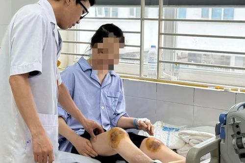 Hoại tử chân do dùng nọc ong chữa bệnh