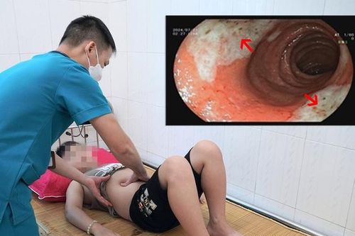 Bé 9 tuổi ở Phú Thọ bị loét hành tá tràng do cha mẹ cho dùng thuốc hạ sốt sai cách