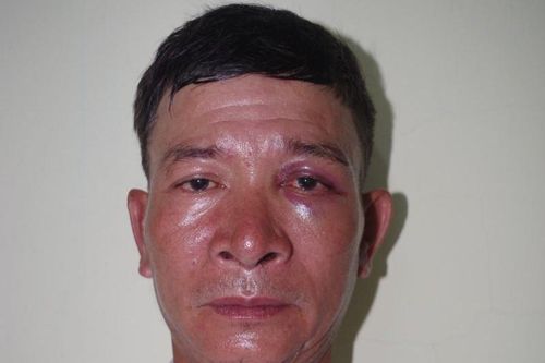 Thanh Hóa: Bắt kẻ vào nơi trông xe của bệnh viện để lừa đảo