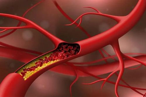 5 thực phẩm giúp giảm cholesterol