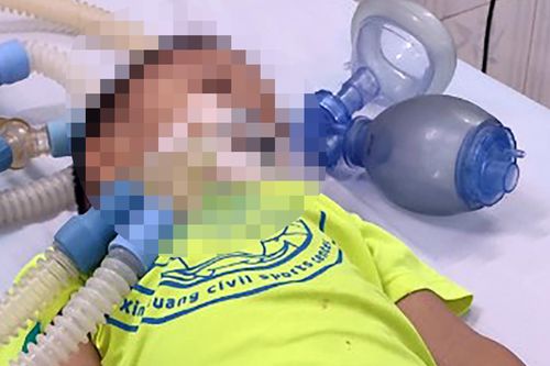 Xác minh thông tin bé 3 tuổi ở Khánh Hòa nguy kịch sau khi ở trường về