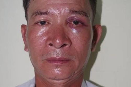 Bắt đối tượng vào nơi trông giữ xe của bệnh viện để lừa đảo
