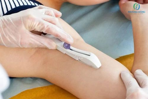 Dùng que tránh thai có ảnh hưởng gì đến quá trình có thai sau này?