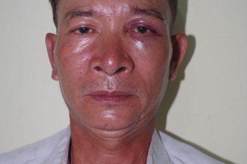 Thanh Hóa: bắt đối tượng lẻn vào bệnh viện làm chuyện xấu